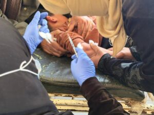 صحة الرقة تعلن السيطرة على اللشمانيا في الهيشة: 80% تراجعاً في الإصابات