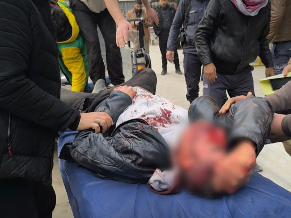 إصابات عديدة بينهم عنصر في الجيش السوري باستهدافات قسد لأحياء مدينة حلب