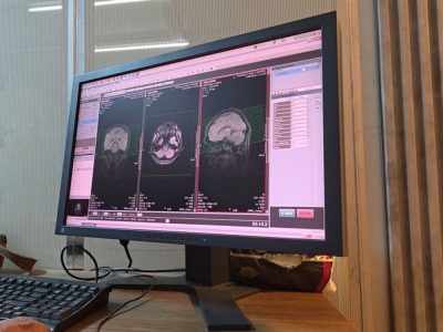 صحة دير الزور تشغل جهاز رنين مغناطيسي في المناطق المحررة حديثاً