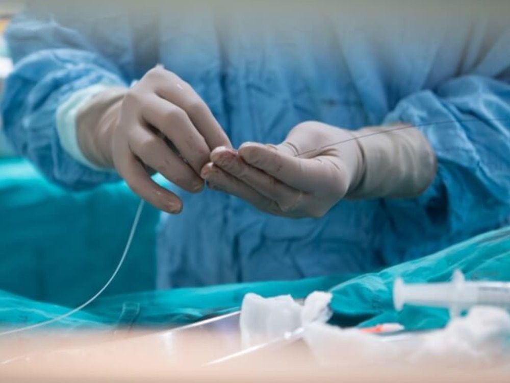 وزارة الصحة تطلق حملة طبية مجانية لقسطرة قلب الأطفال في دمشق